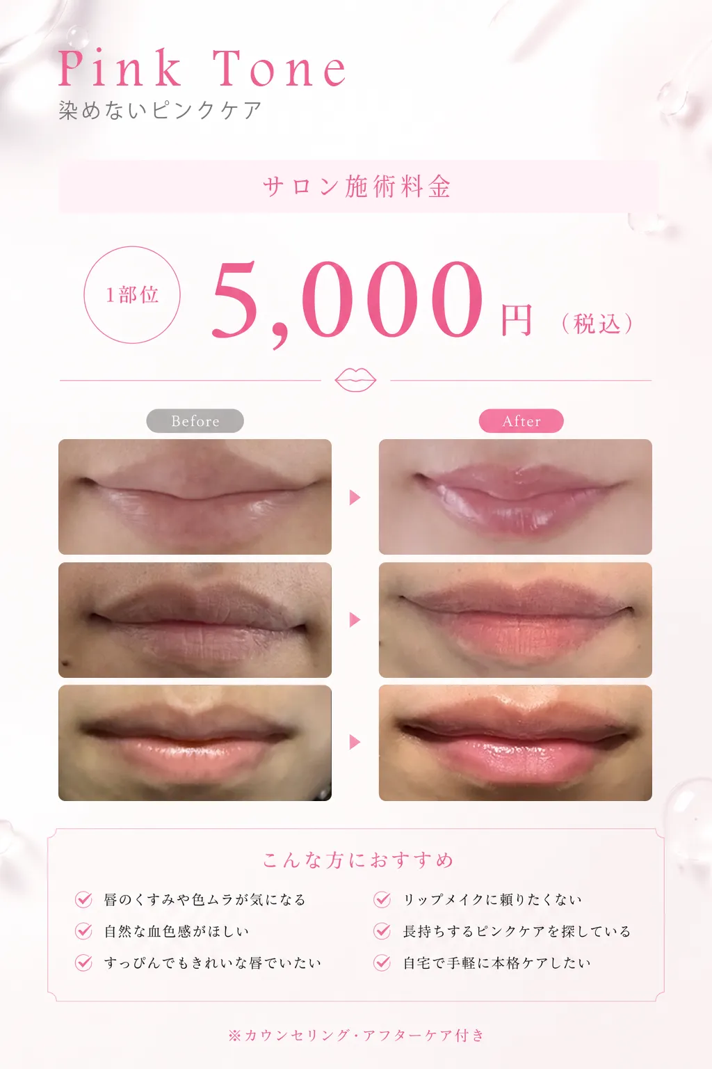 pinktone_3